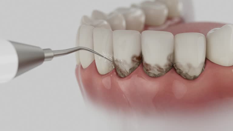 Reliable Emergency Dentist contractor in Yankton, SD by Smile Center Dentistry